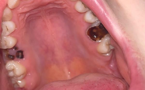 Mám hrozné zuby a bojím sa ísť k zubárovi