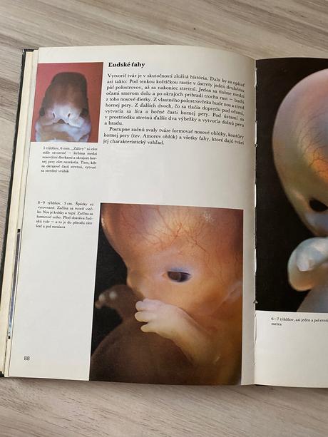 Krásna kniha čakáme dieťatko,