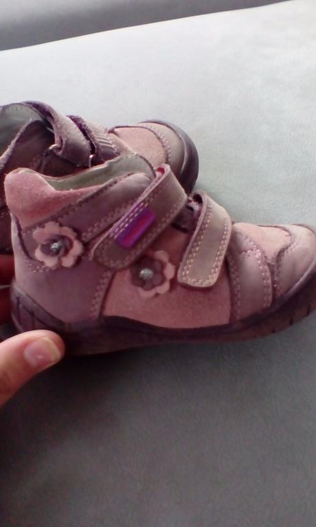 Prechodné topánočky protetika, protetika,22