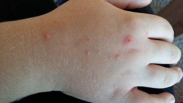 Sú to kiahne podľa vás?