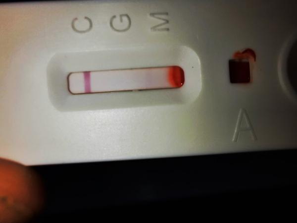 Krvný rýchlotest IgG/IgM - Covid-19