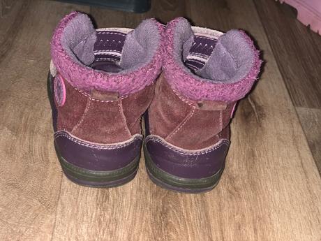 Zimne cizmy protetika, protetika,23
