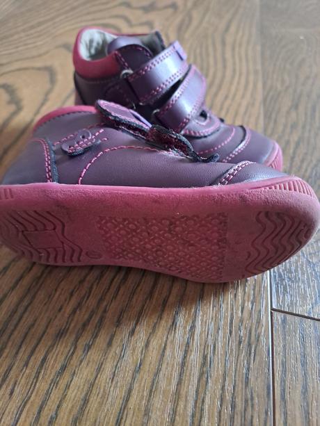 Topánky protetika dievčenské, protetika,21