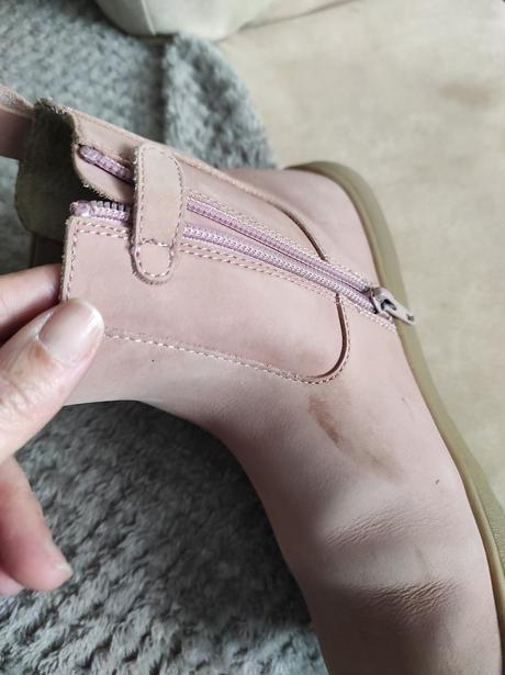 Prechodné barefoot topánky protetika, protetika,36