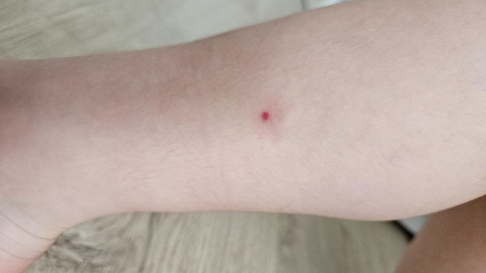Je to štípanec alebo niečo vážnejšie? - Modrý koník