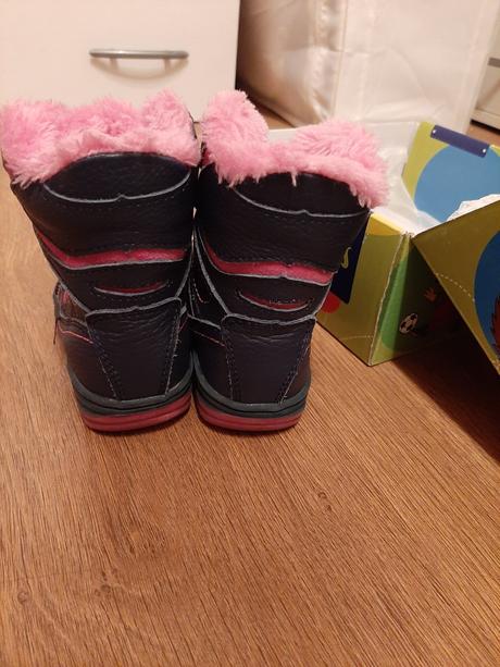 Zimne topanky protetika, protetika,21