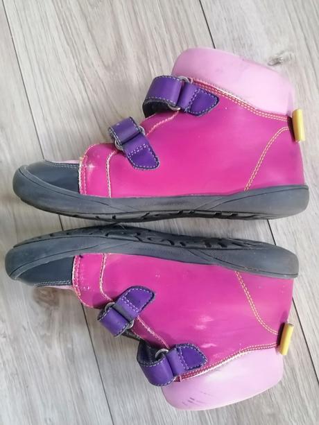 Topánky kotníkové protetika, protetika,33