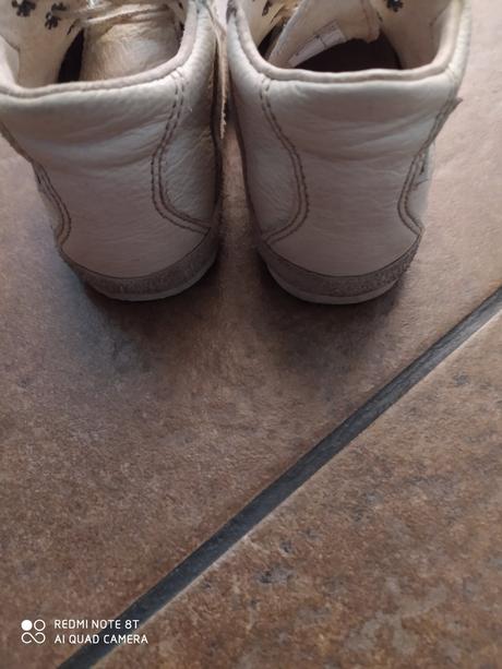 Prvé topanocky, pegres,19