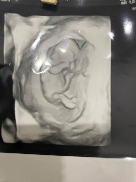 Bude to dievča alebo chlapec?