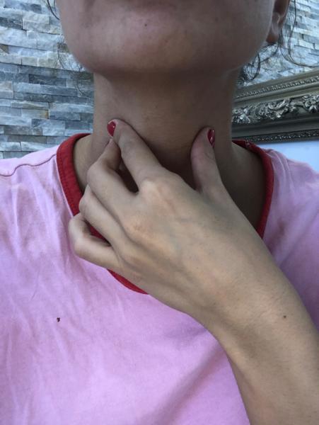 Prečo ma bolí krk v mieste uzlín?