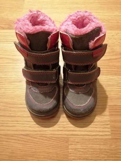 Topanky protetika, protetika,22