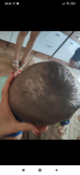 Čo to má môj synček na hlave?