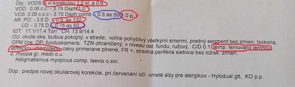 Prečo mi očná predpísala iba cylinder na ľavé oko?