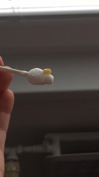 Môžem 3-týždňovej odsávať soplíku vysávačom?