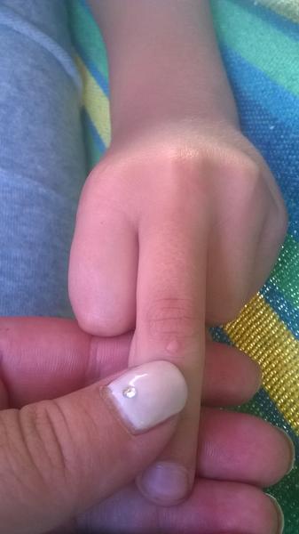 Vyrážky u 6 ročného syna