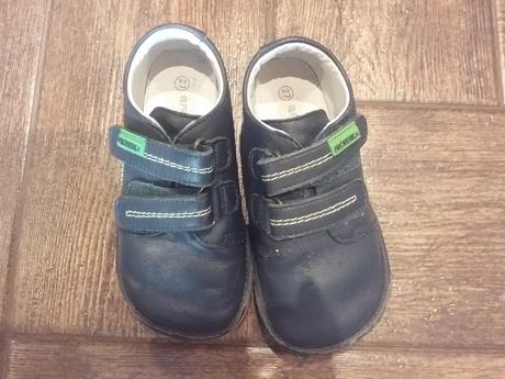 Protetika kozene, protetika,27