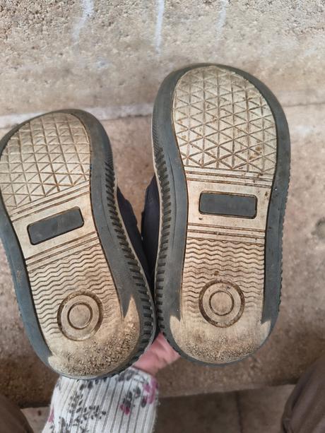 Prechodné topánky protetika, protetika,25