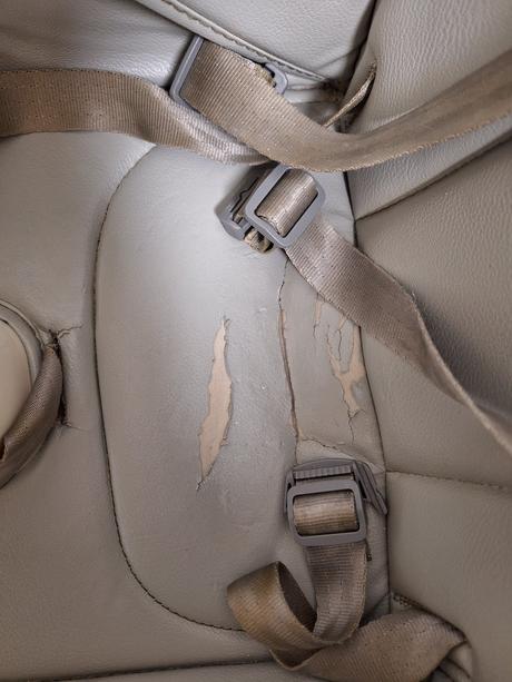 Stolička zopa, zopa