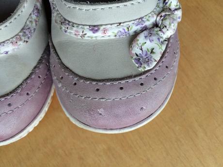 Kozene sandalky, protetika,24