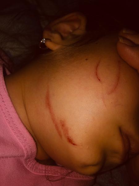 Dcéra spadla a má škrabanec