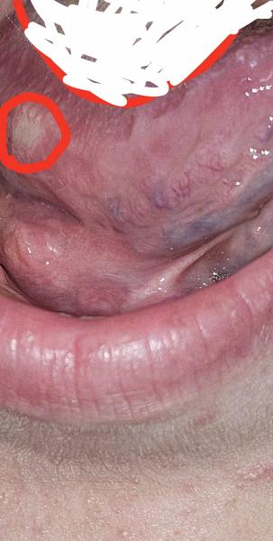 Potrebujem poradiť predtým ako začnem panikáriť