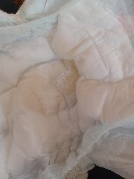 Nezvyčajný zápach moču u 6-mesačného bábätka?