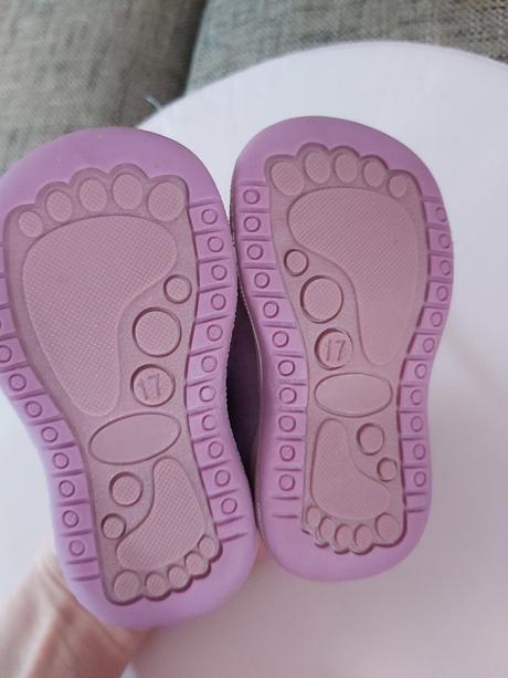 Protetika prve topanky vel.17, protetika,17