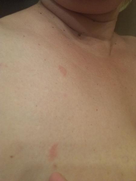 Čo si mám dať na takýto výsyp? Mám HIT