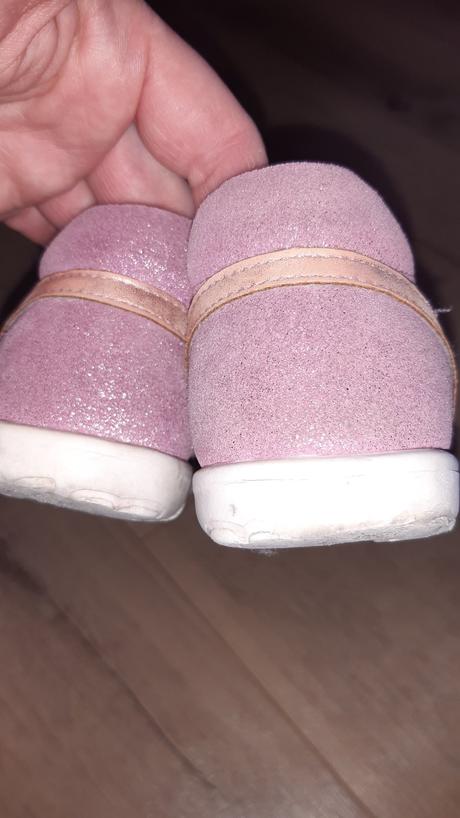 Sandále  na leto, protetika,24