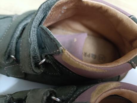 Barefoot protetika, protetika,33