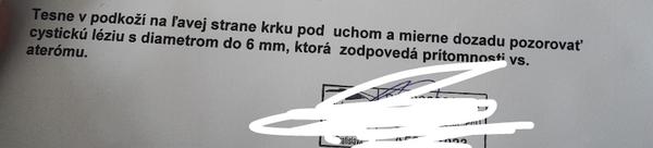 Veľká hrčka na krku