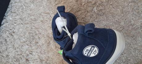 Nové protetika tenisky, protetika,31 / 33 / 35