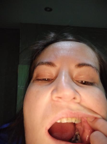 Čo to mám v ústach?