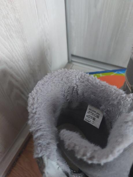 Čižmy protetika, protetika,33