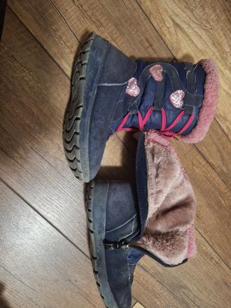 Čižmy protetika, protetika,27