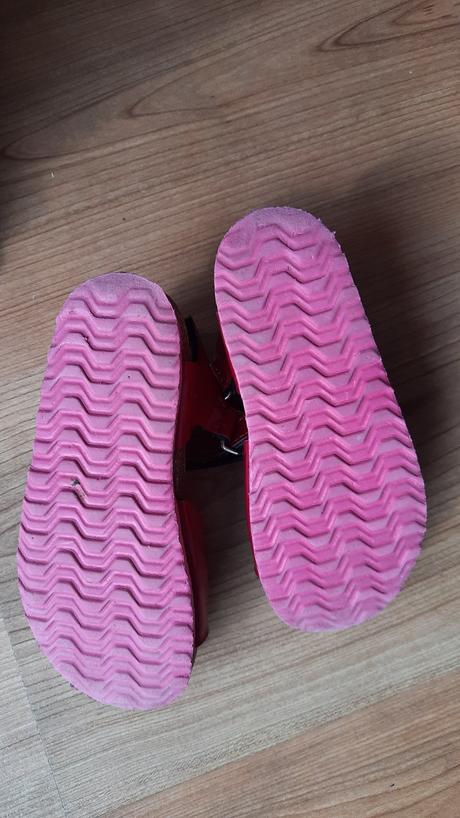 Protetika krasne letne sandalky, protetika,27