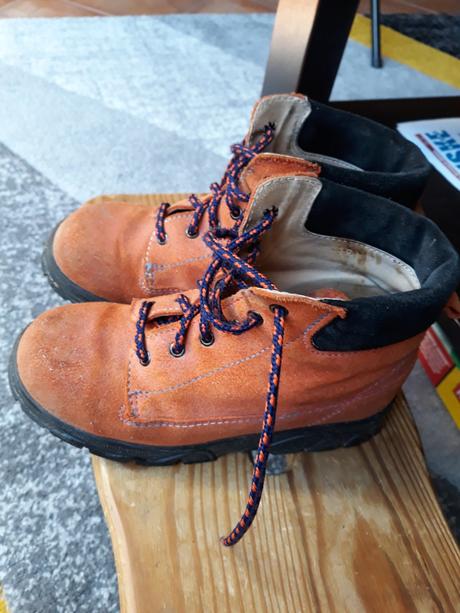 Prechodne ortopedicke topanky, protetika,29