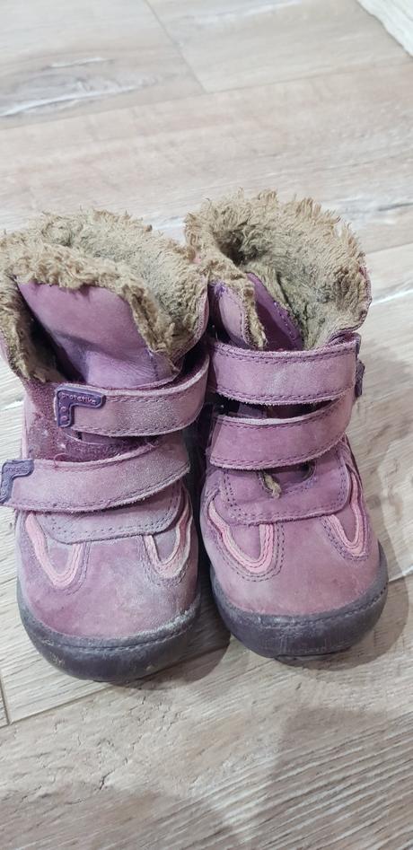 Zimné čižmy protetika, protetika,25