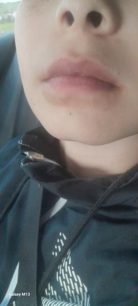 Ako odstrániť hnedú škvrnu pod perou?