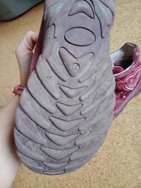 Čižmy protetika, protetika,31