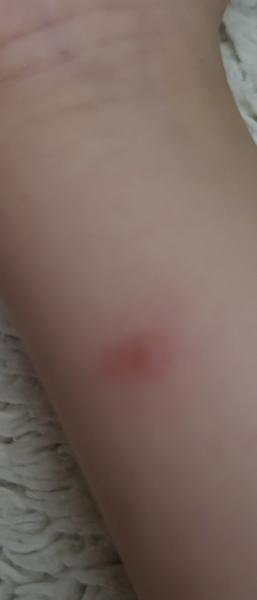 Sú toto ovčie kiahne?