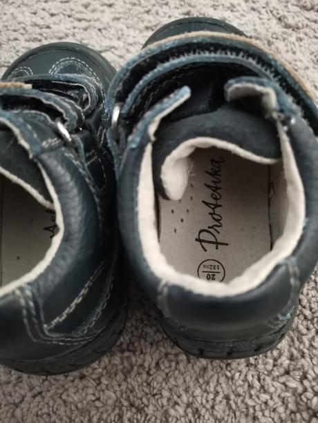 Topánočky protetika, protetika,20