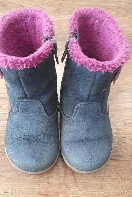 Čižmičky protetika v.21, protetika,21