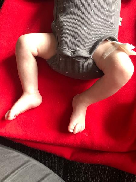 Ako pomôcť 6-týždňovému bábätku s otáčaním chodidiel?