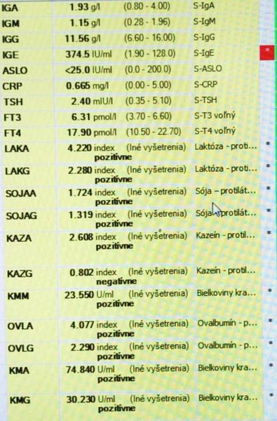 Mám iba intoleranciu mlieka?