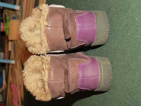 Zimné topánočky, protetika,21