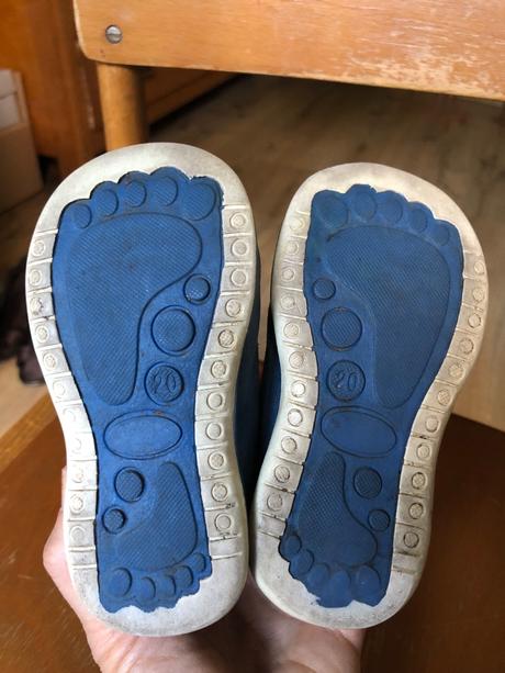 Šnurovacie poltopánky protetika, protetika,20