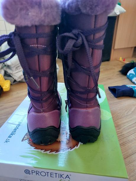 Zimne cizmicky protetika, protetika,28