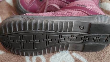 Protetika botičky, protetika,25