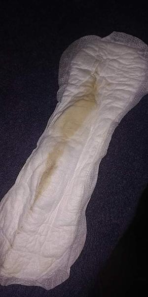 Výtok v 36. týždni + 2 dni